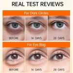 SADOER 5X Heavy 5-in-1 Active Vitamin C Anti-Wrinkle & Dark Circles Eye Cream